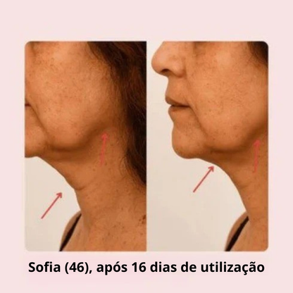Máscara de Lifting Facial V-Line