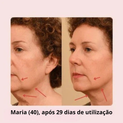 Máscara de Lifting Facial V-Line