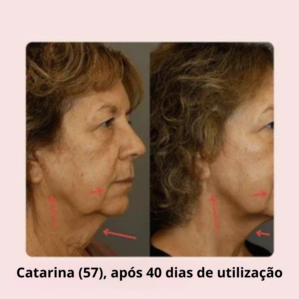 Máscara de Lifting Facial V-Line